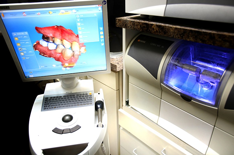 CEREC and 3D scan.jpg