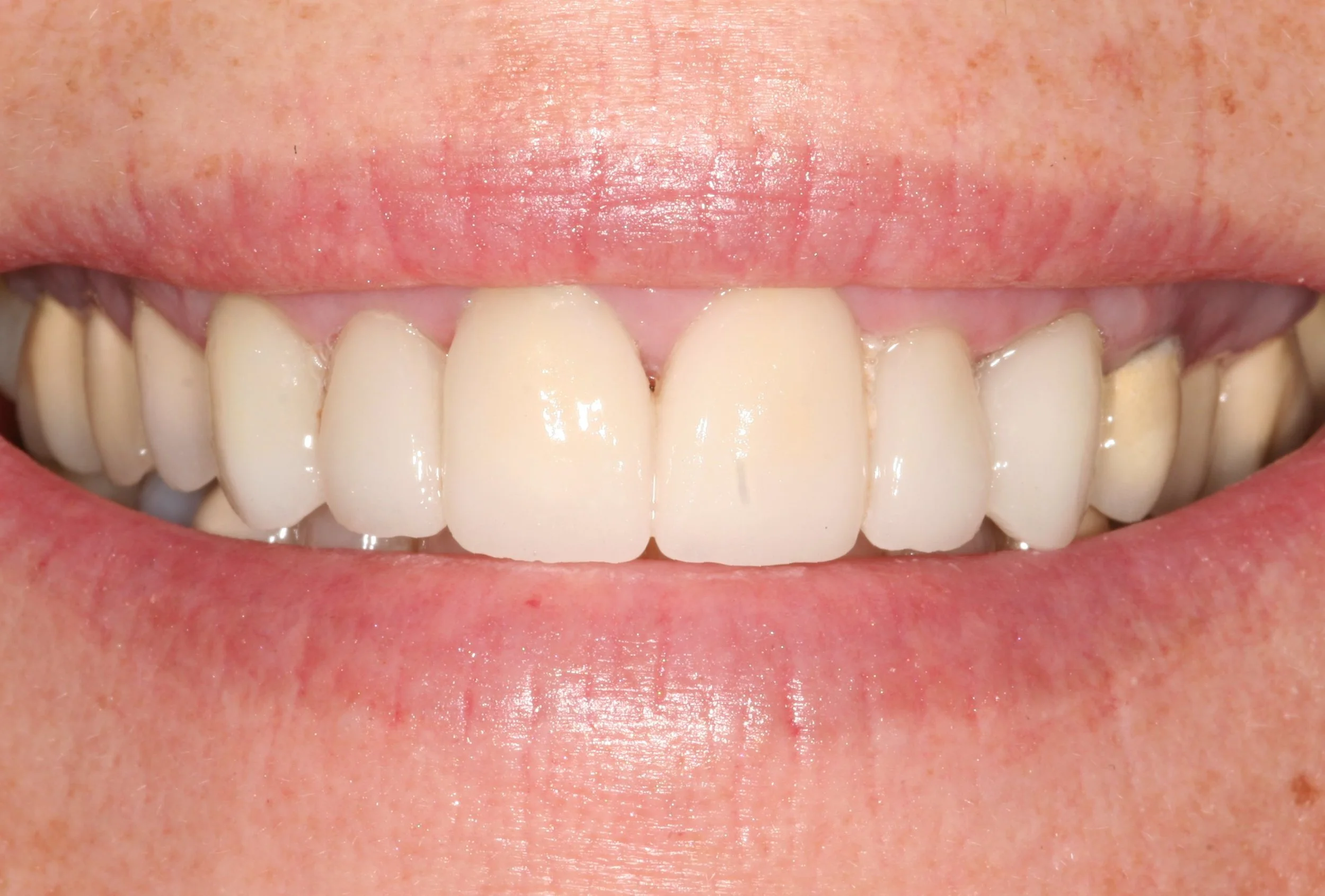 Susan's Story Aesthetic Family Dental Care