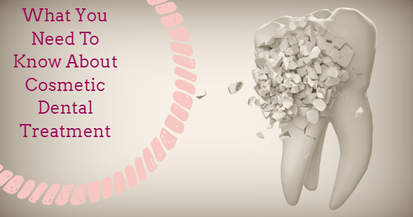 What You Need To Know About Cosmetic Dental Treatment