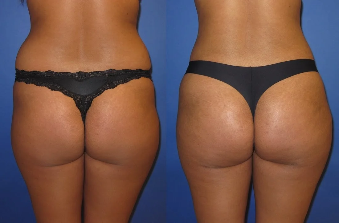 JPEG image-3BCAAB350C5E-1.jpeg