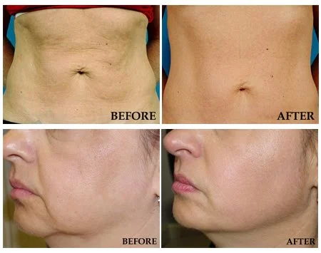 JPEG image-5070A183EE5C-1.jpeg