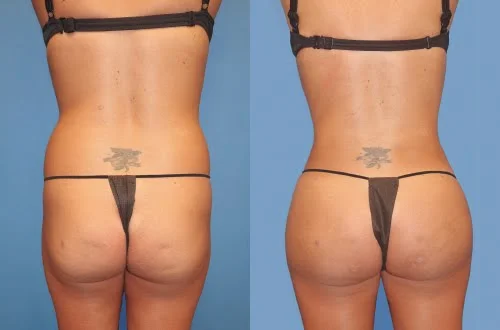 JPEG image-B78D713A5CF4-1.jpeg