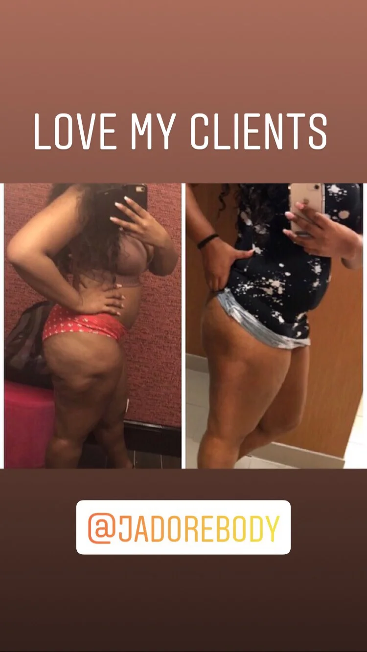 cellulite treatment .jpeg