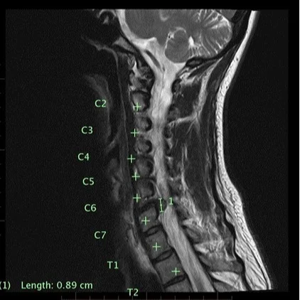 neck+image.jpg