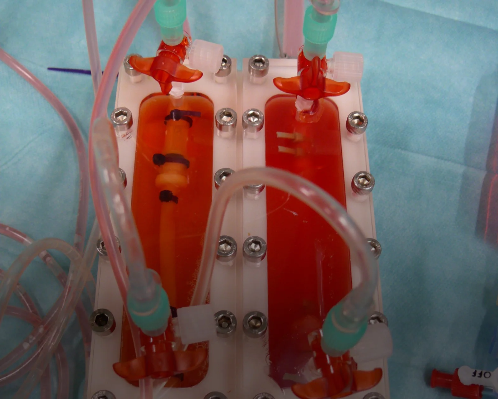 Regenerating Organs for Transplant