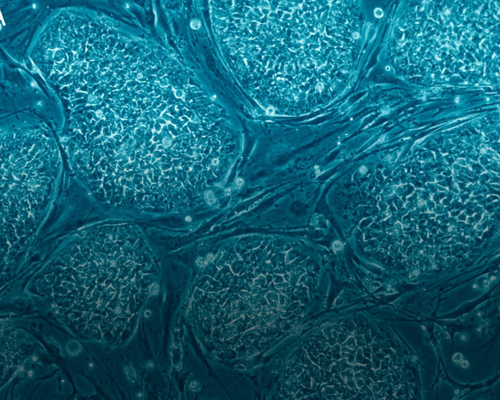 The Promise and Challenge of Stem Cells