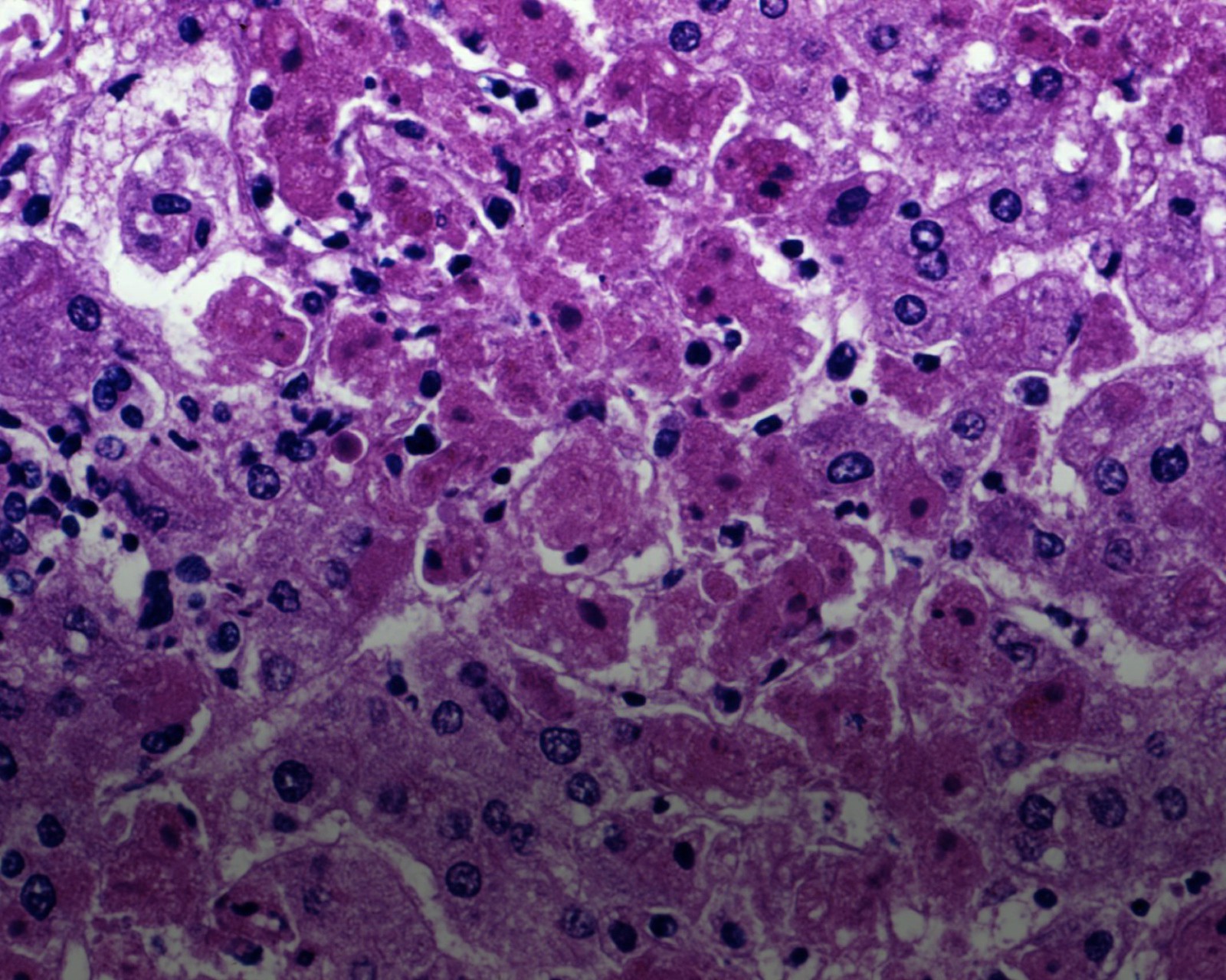 On Livers and Lymph Nodes