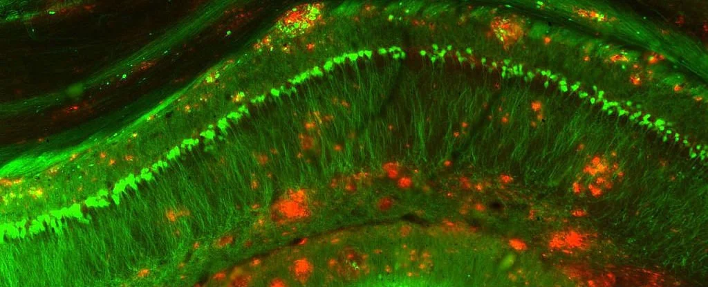 mouse-model-alzheimers_1024