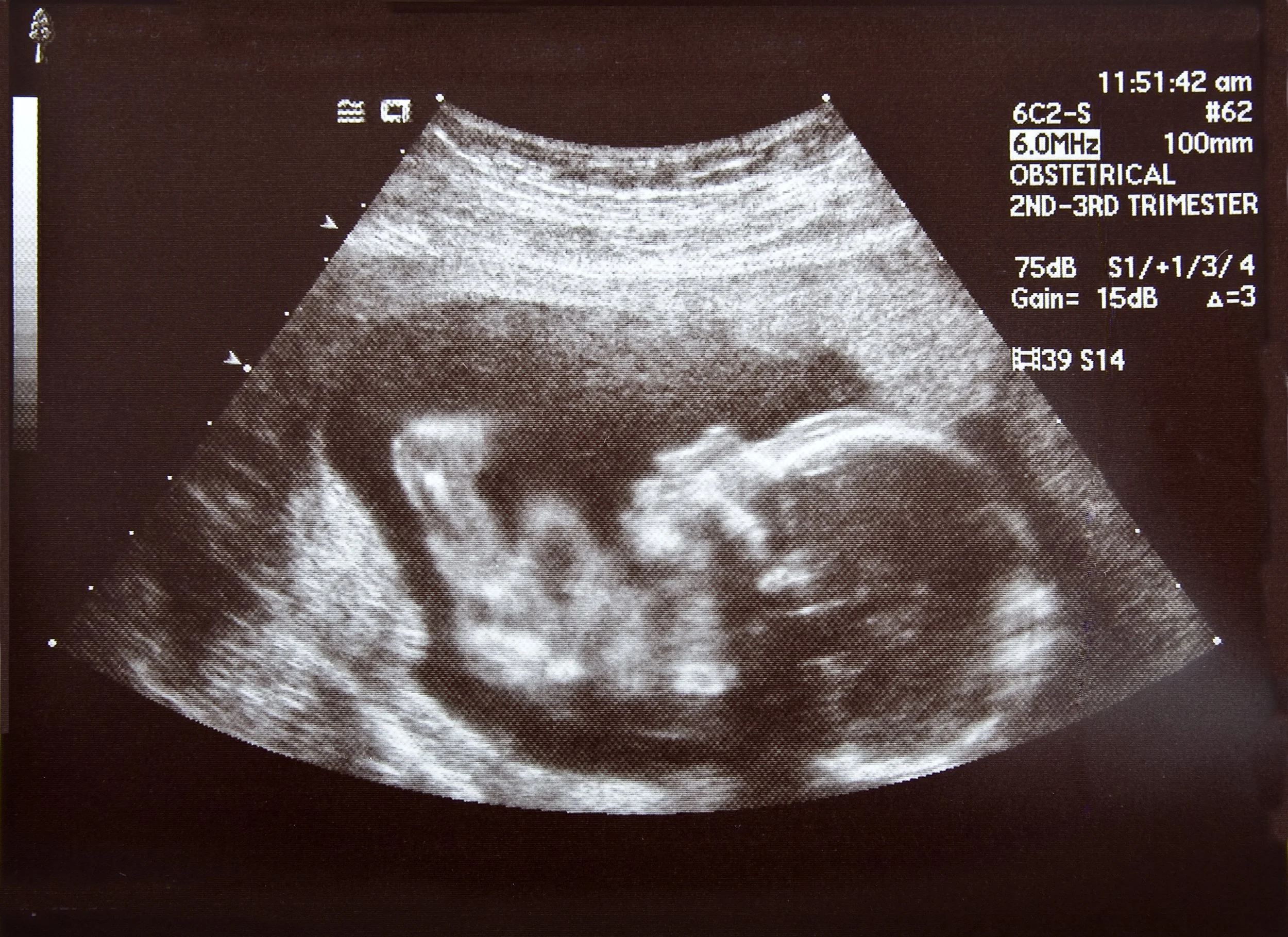 Unlocking Secrets of Youth: The Promise of Synthetic Embryo Research