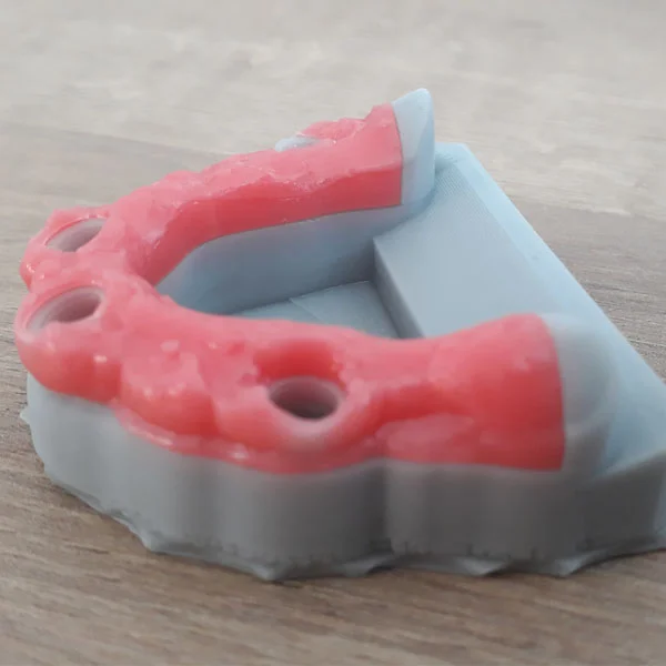 dentifix_gingiva_1.jpg