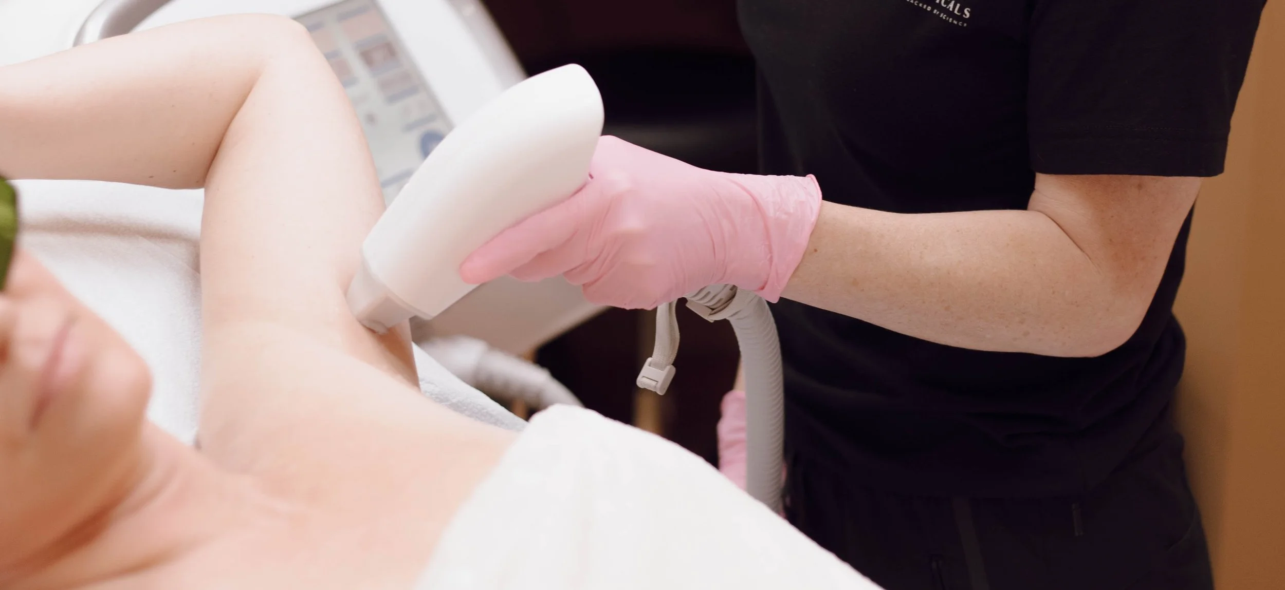 How Many Laser Hair Removal Treatments Do You Need?