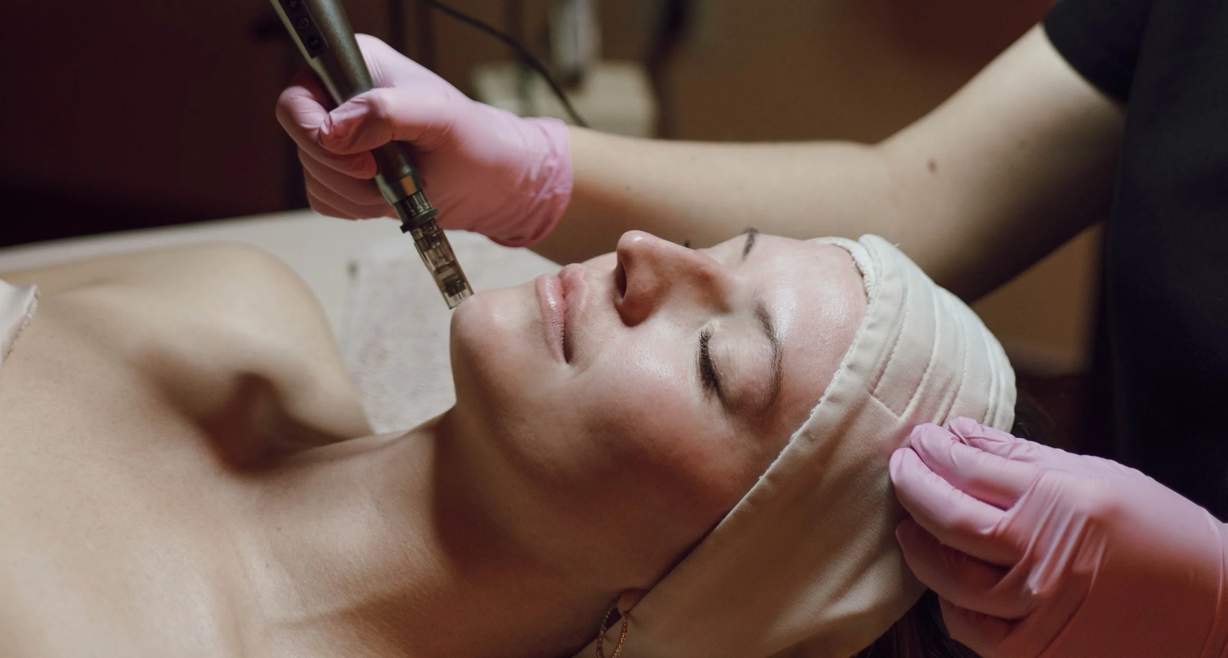 Microneedling: What It Does, What to Expect &amp; Is It Worth It?