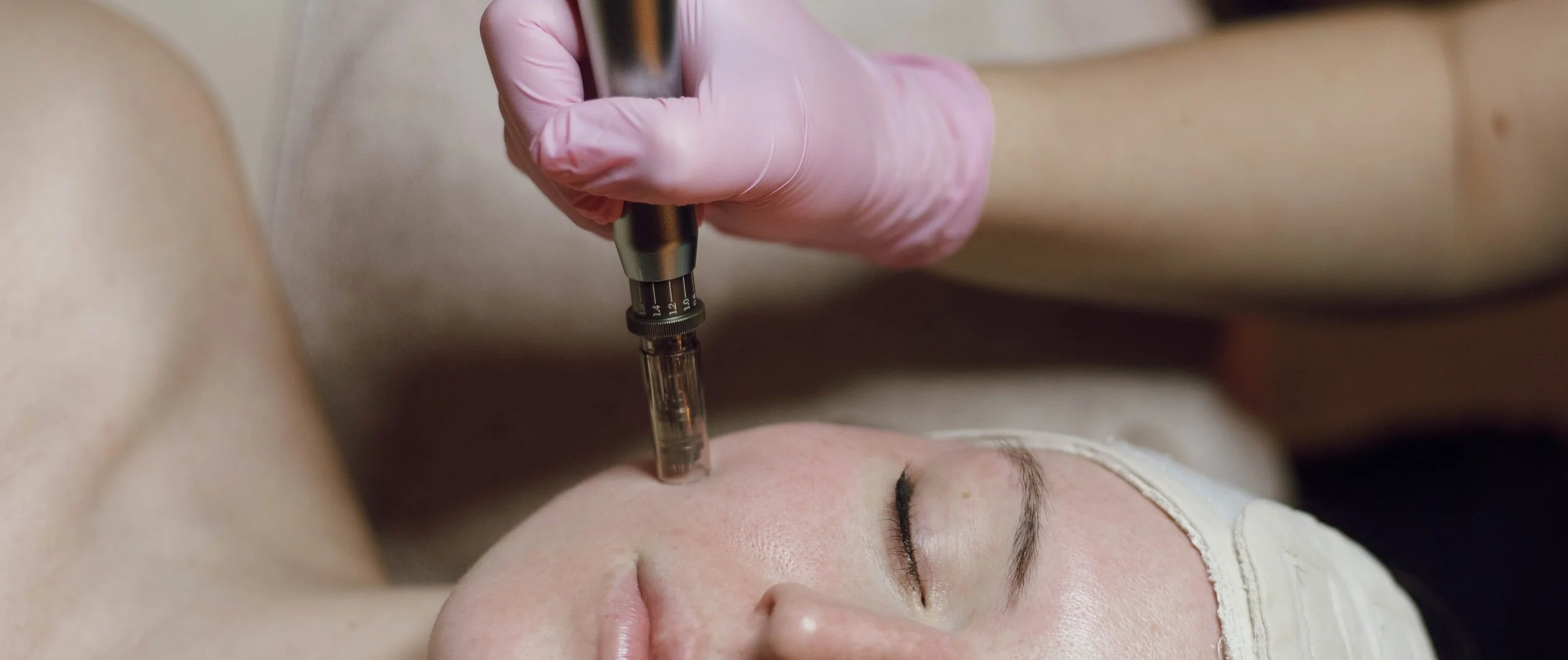 Microneedling at Larimar Medspa, Chattanooga, TN