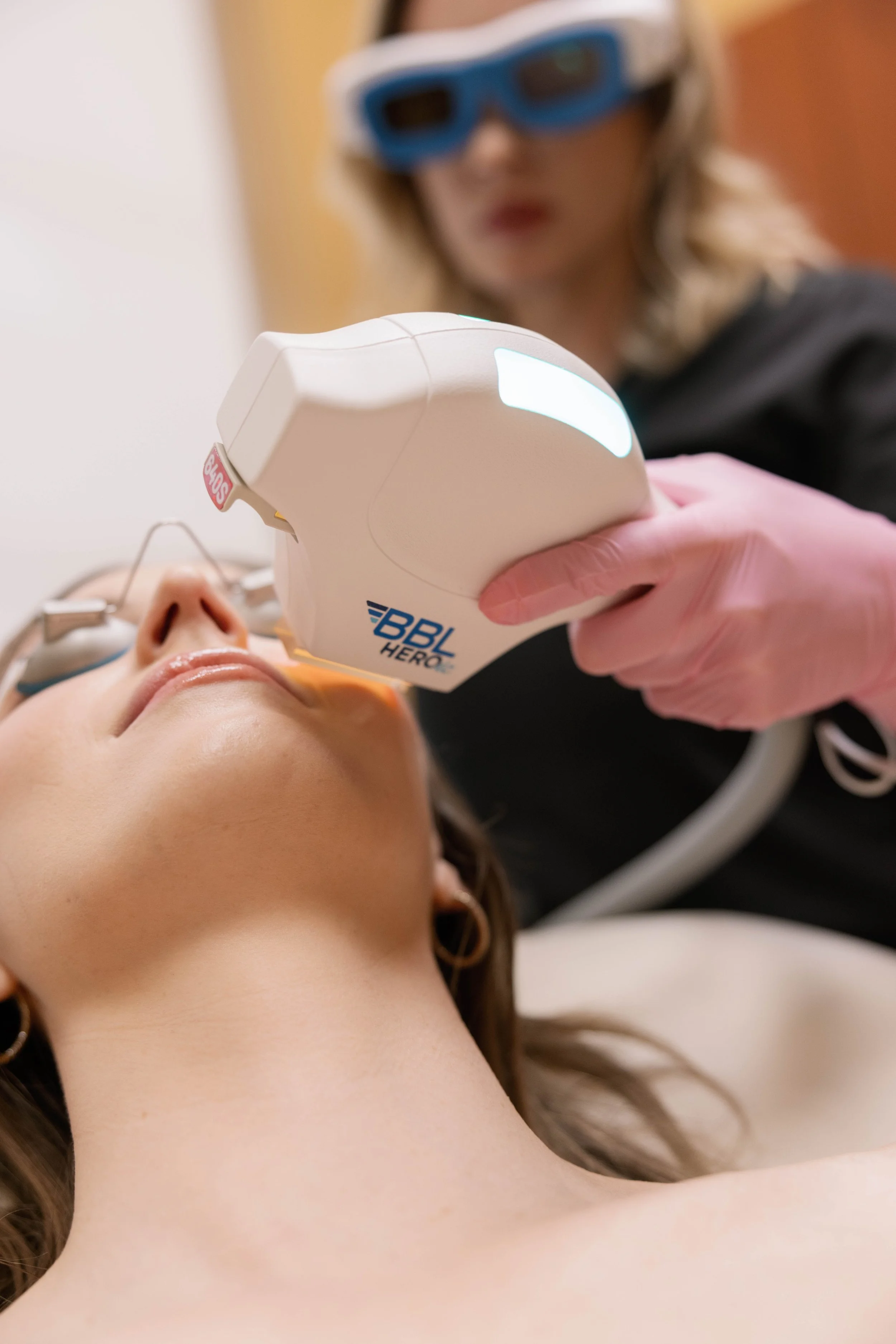 BBL HEROic skin treatment at Larimar Medspa