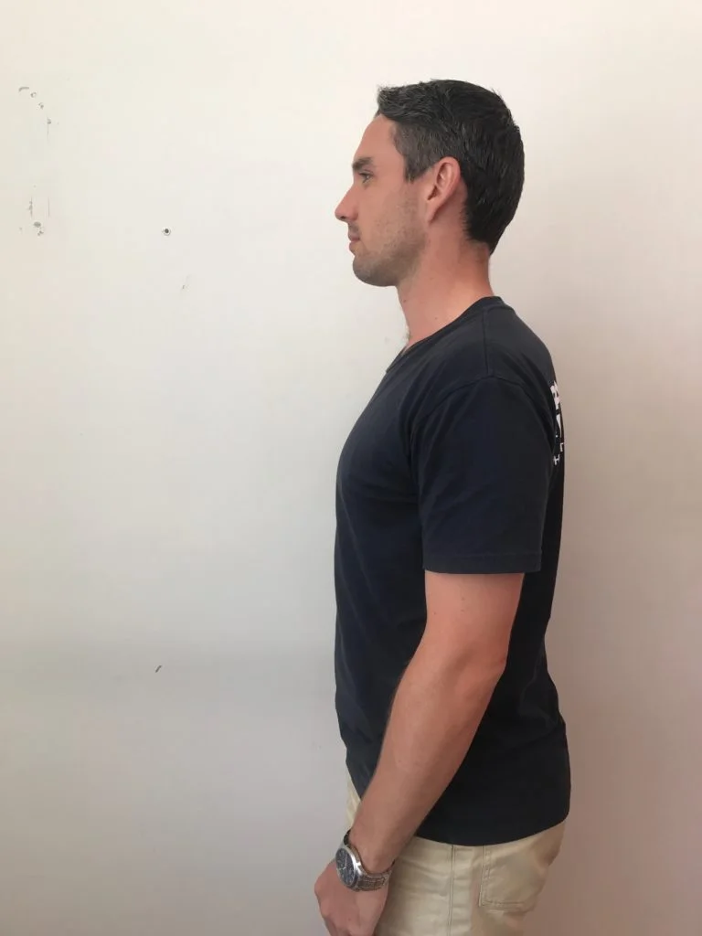 Poor Posture.jpg