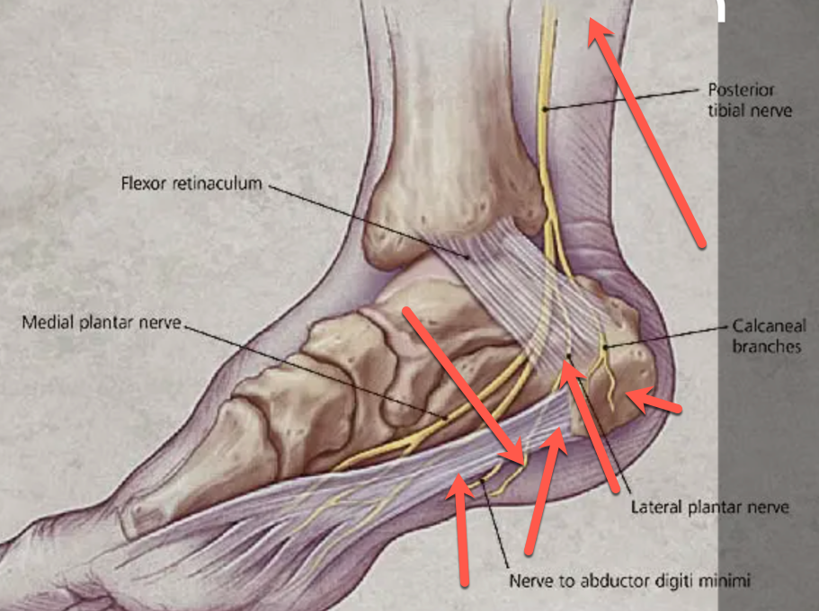Not All Heel Pain is Plantar Fasciitis