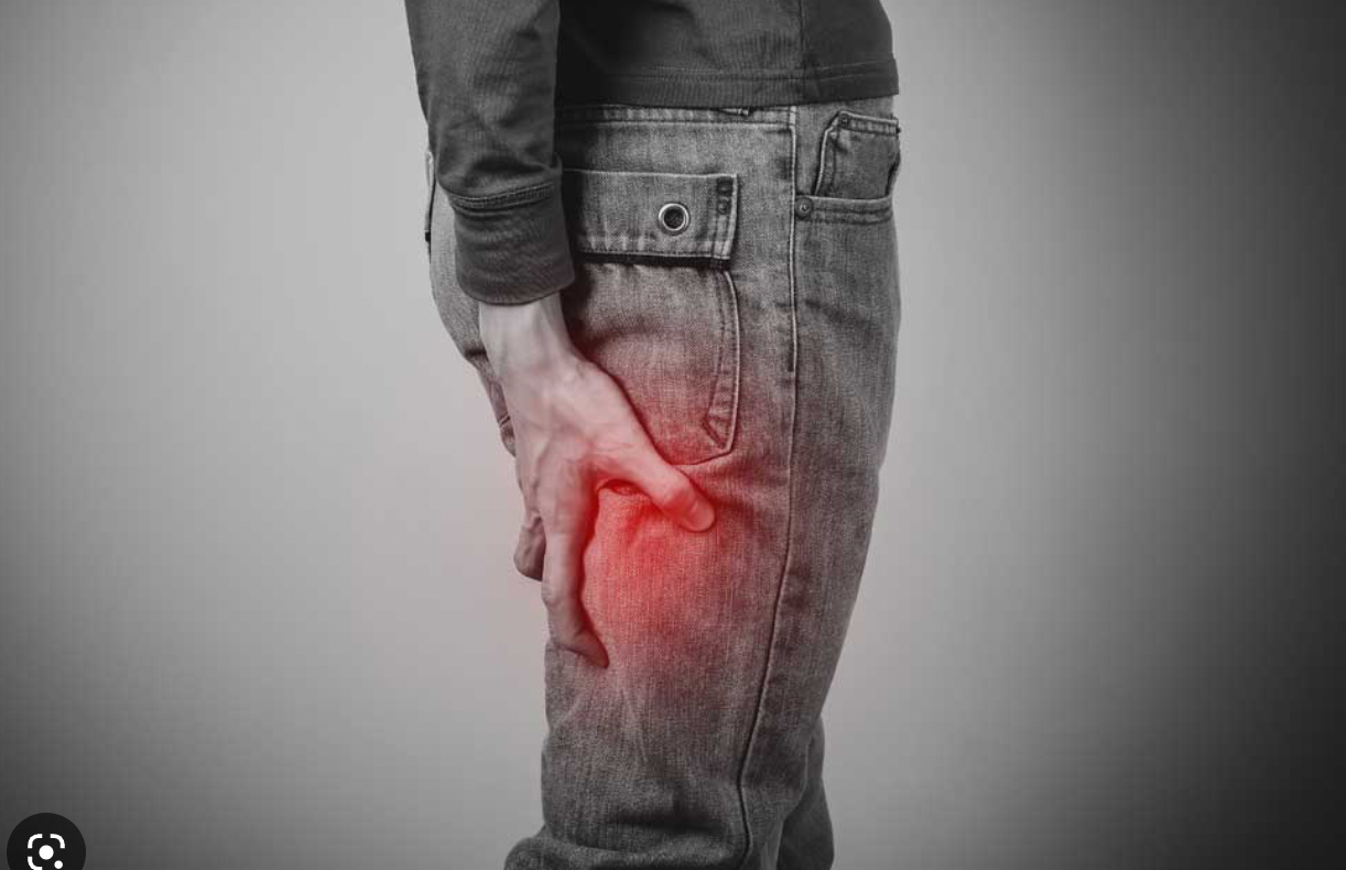 Do You Have Sit Bone Pain?