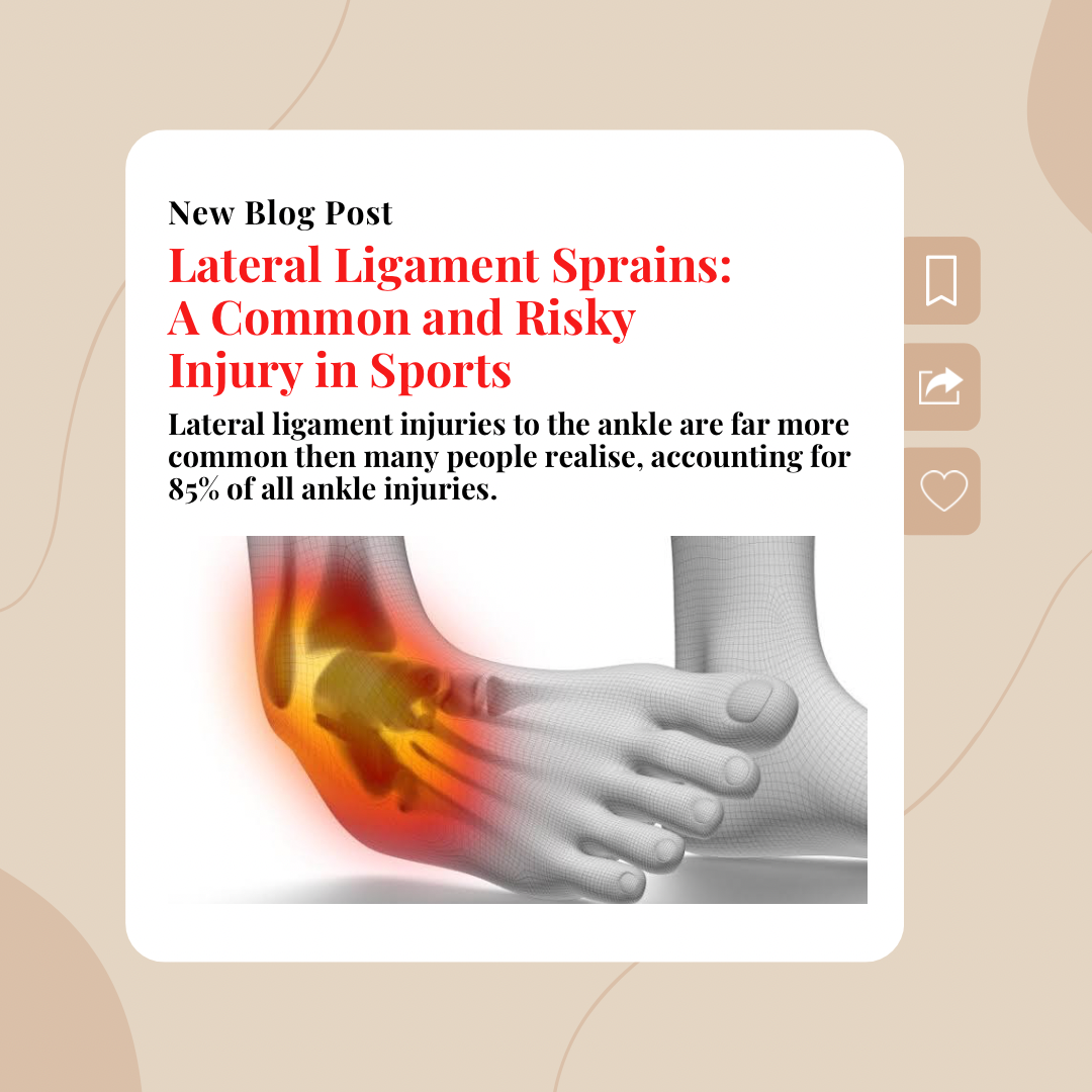 Lateral Ligament Sprains: A Common and Risky Injury in Sports