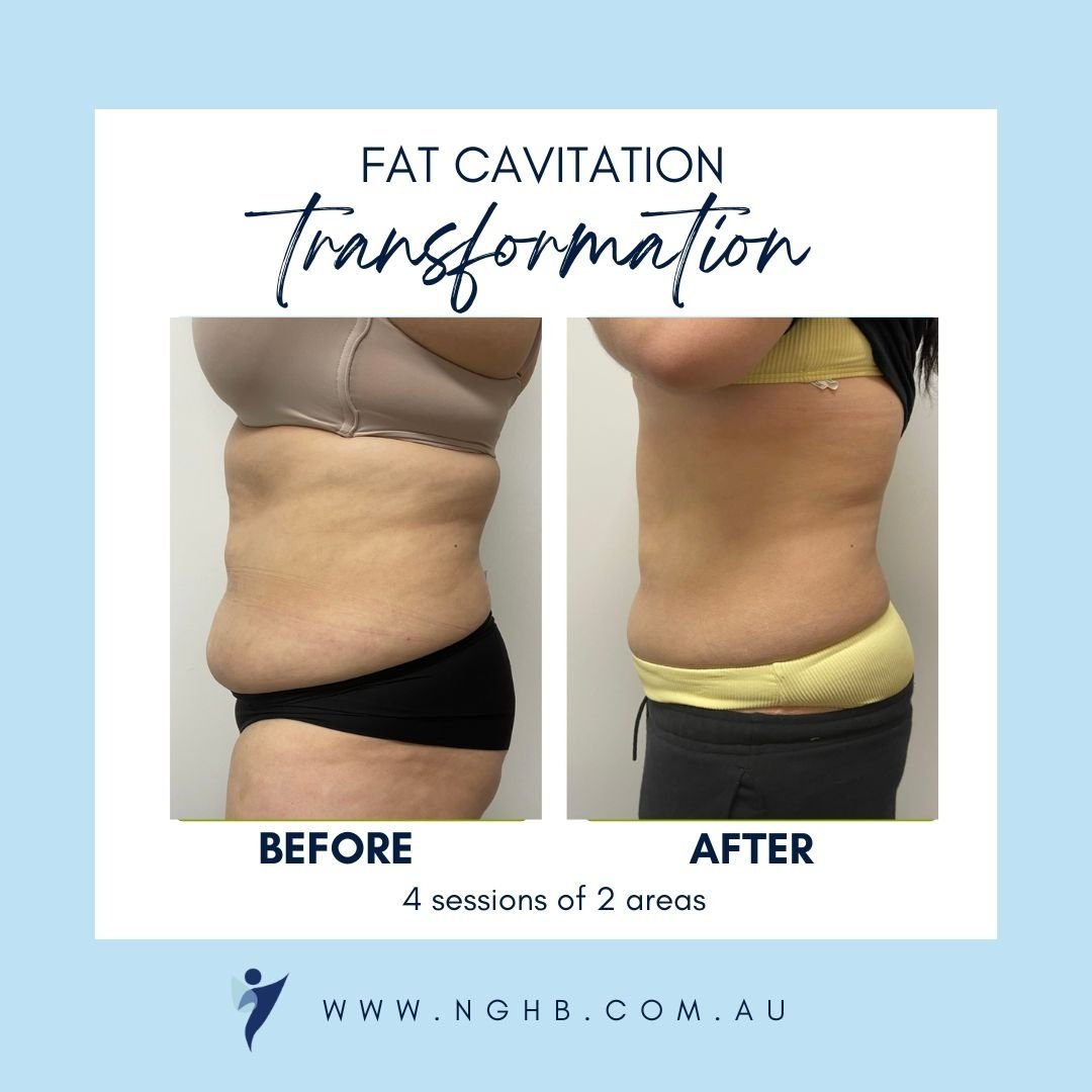 Yet another amazing transformation.  Take advantage of our buy 3 get one free.  Offer ends end of May!  Pre-purchase available.  Book on-line or DM us for more information.