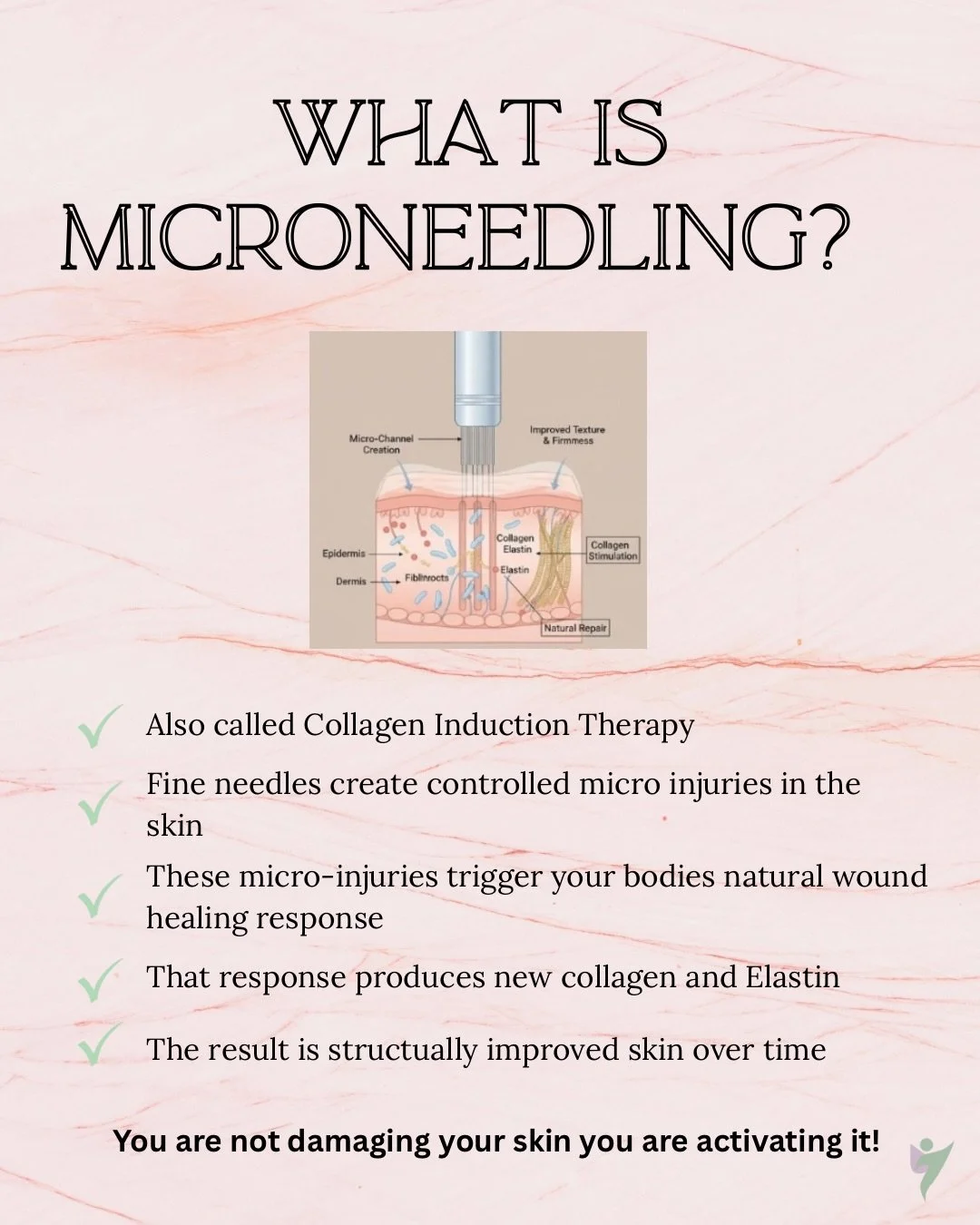 Everything you need to know about Microneedling. Education is power!  DM us if you have any questions or would like to book a free consultation. 
-
-
-
#microneedling #microneedlingbayside #facial #education #skinclinicmelbourne