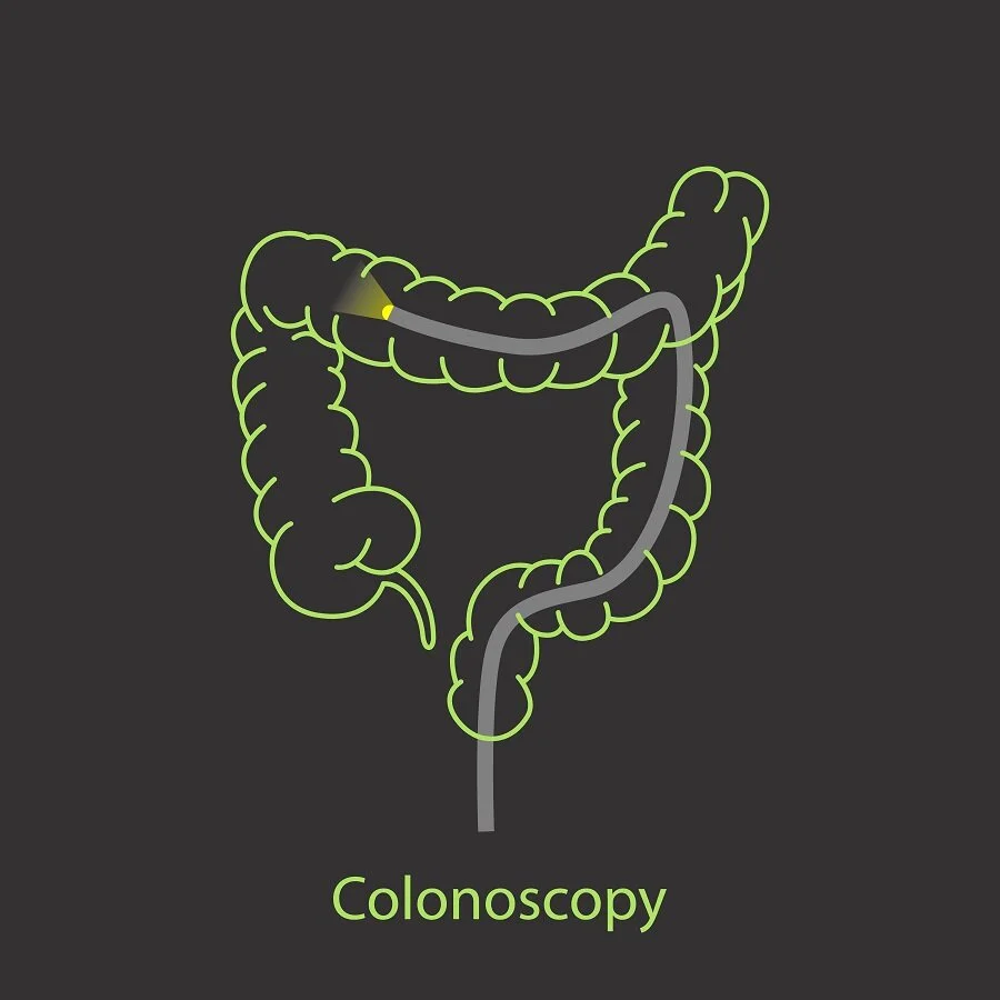 colonoscopy .jpg