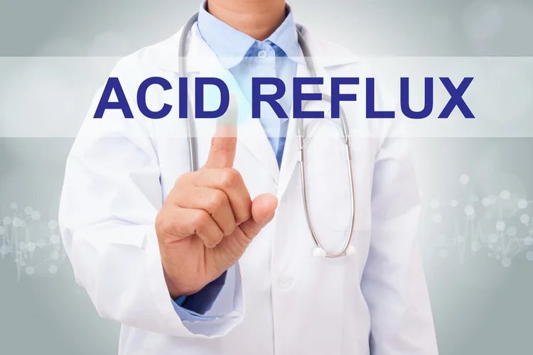 Smart Tips to Avoid Acid Reflux