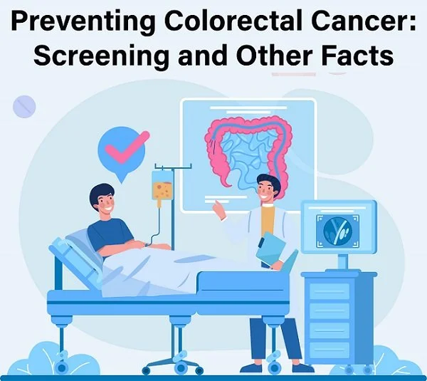 Preventing Colorectal Cancer: Screening and Other Facts