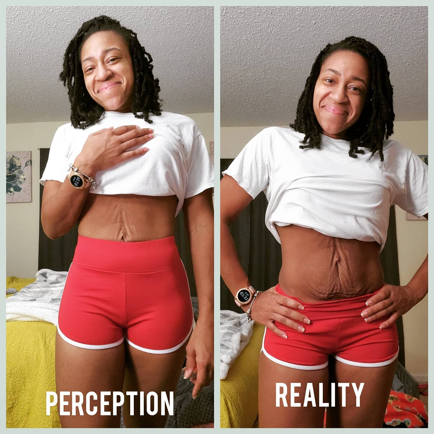 I used to frown upon taking pictures that showed any skin other than the skin that would be exposed in a short-sleeved dress. I had this idea in my head that it was unacceptable for anyone to see my stretch marks and thigh dimples as I now call them?