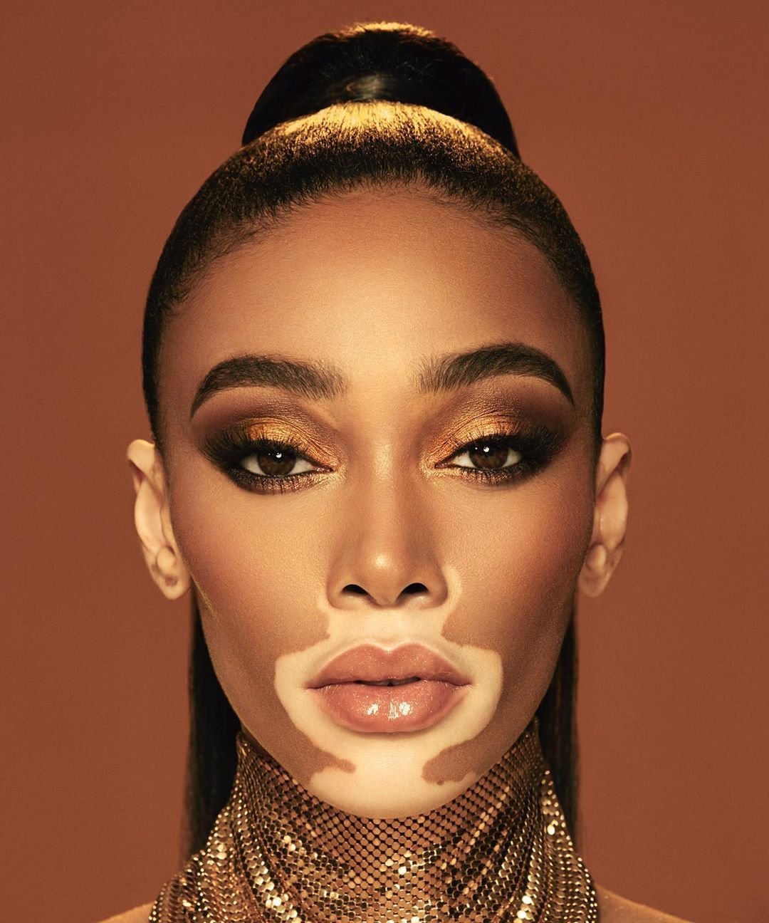 Winnie Harlow