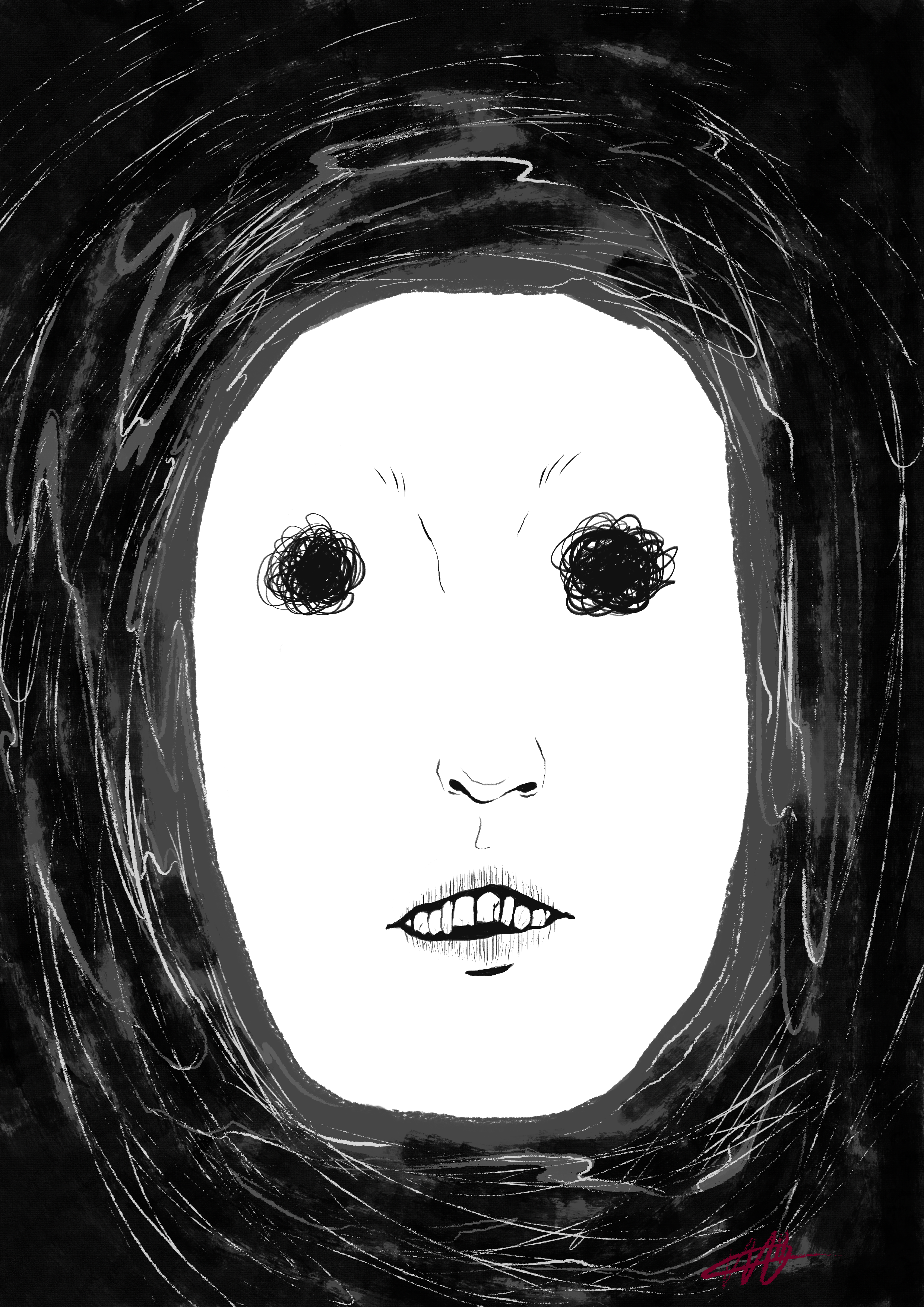 Depression