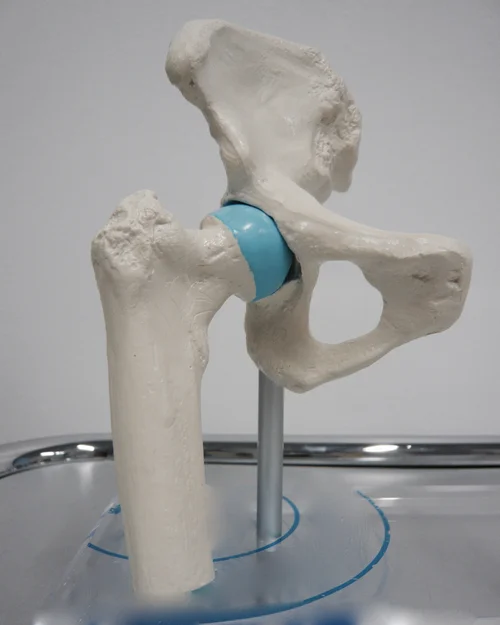 Kunstgelenke - Prothese-Innovationen fr Schulter, Hfte, Knie | Dr. med.  Matthias Schmied | Orthopdie Zrich