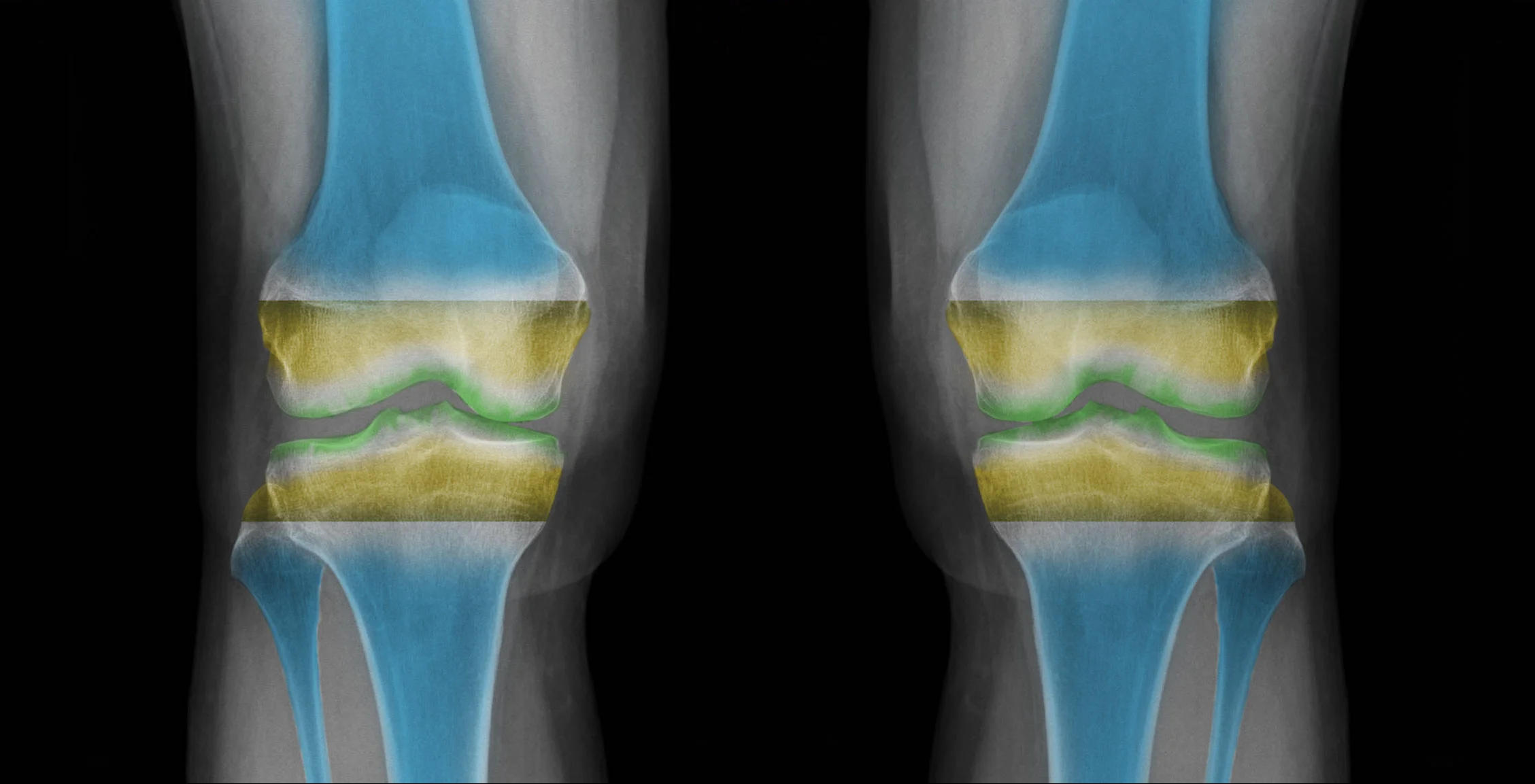 Healthy_Knee_Ortho4Life.jpg