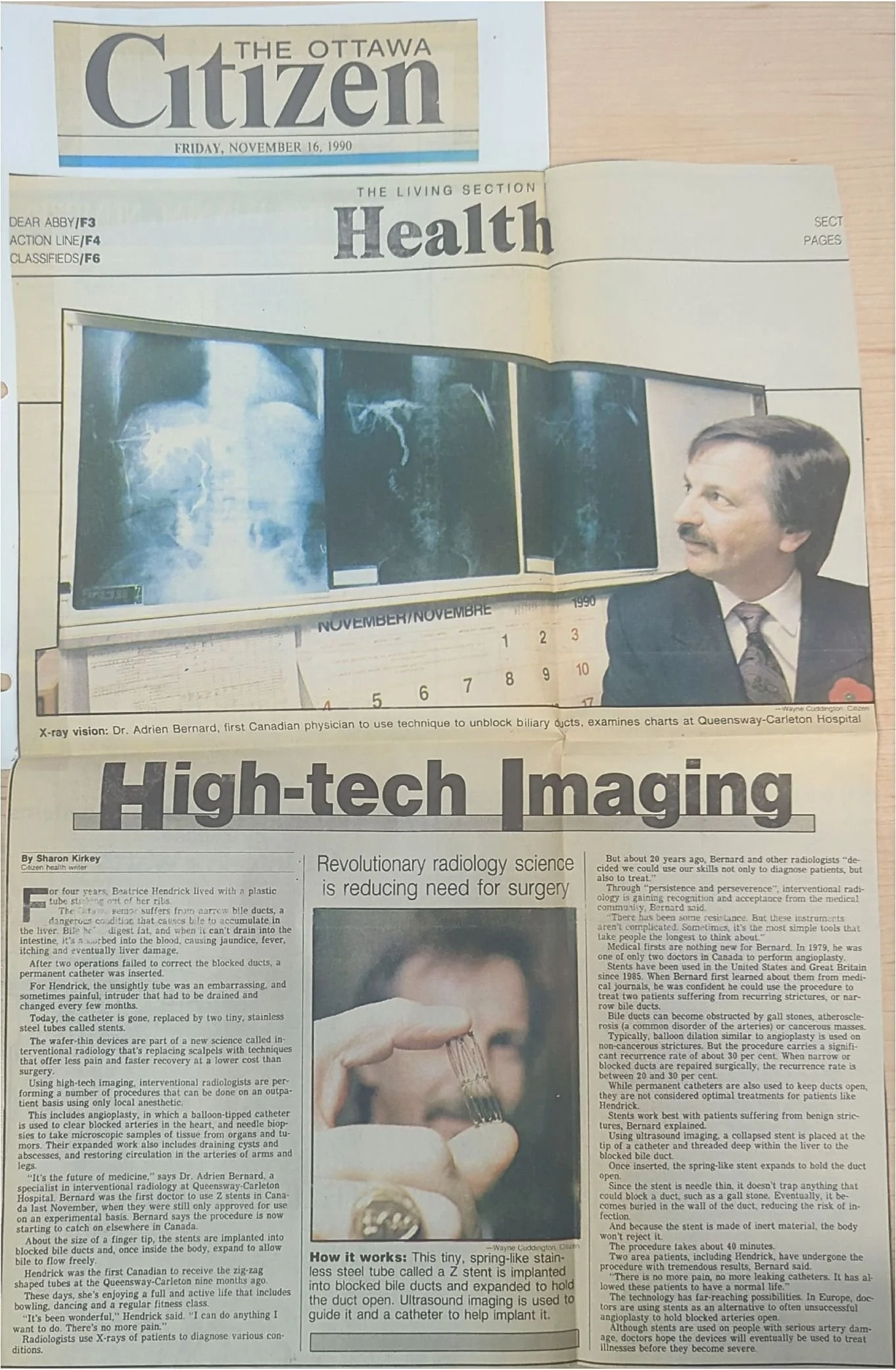 1990-11-16-High-tech Imaging-The Ottawa Citizen.jpg