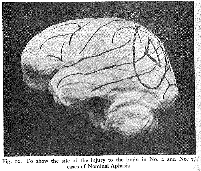 ch.4.Head AKDS 456.png