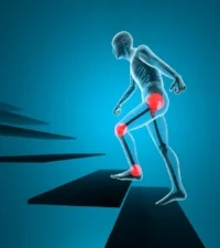 knee-pain-when-climbing-stairs.jpg