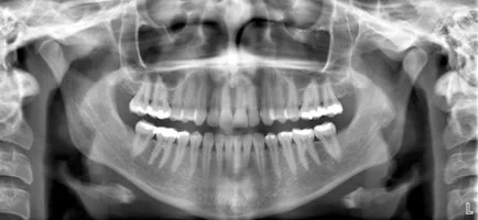 ProOne-Digital-Panoramic-Dental-X-Ray-Planmeca-USA-1.jpg