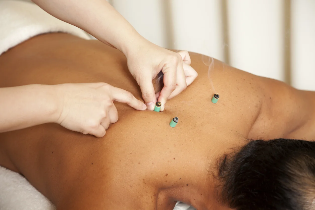 moxibustion-therapy-cyprus.jpg