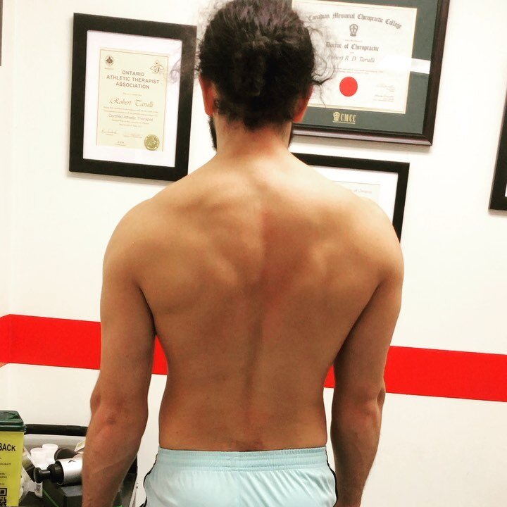 This post is to highlight the importance of incorporating scapular CARs with shoulder training, especially prior to overhead loading, such as during the snatch, jerk or a volleyball spike.
▪️
Why? There is inherent coupling of the scapulothoracic and