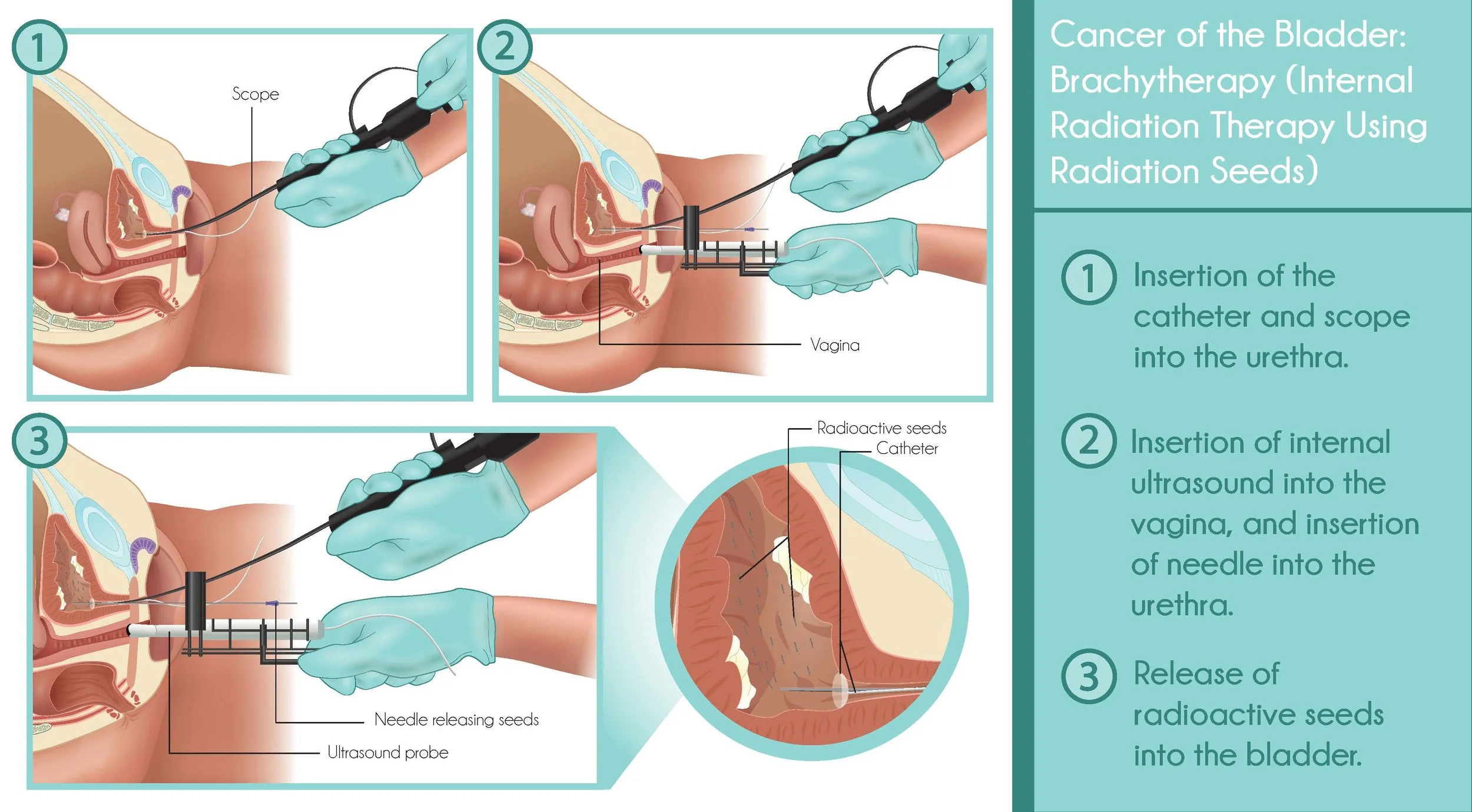 Procedure images property of ScienceMedia