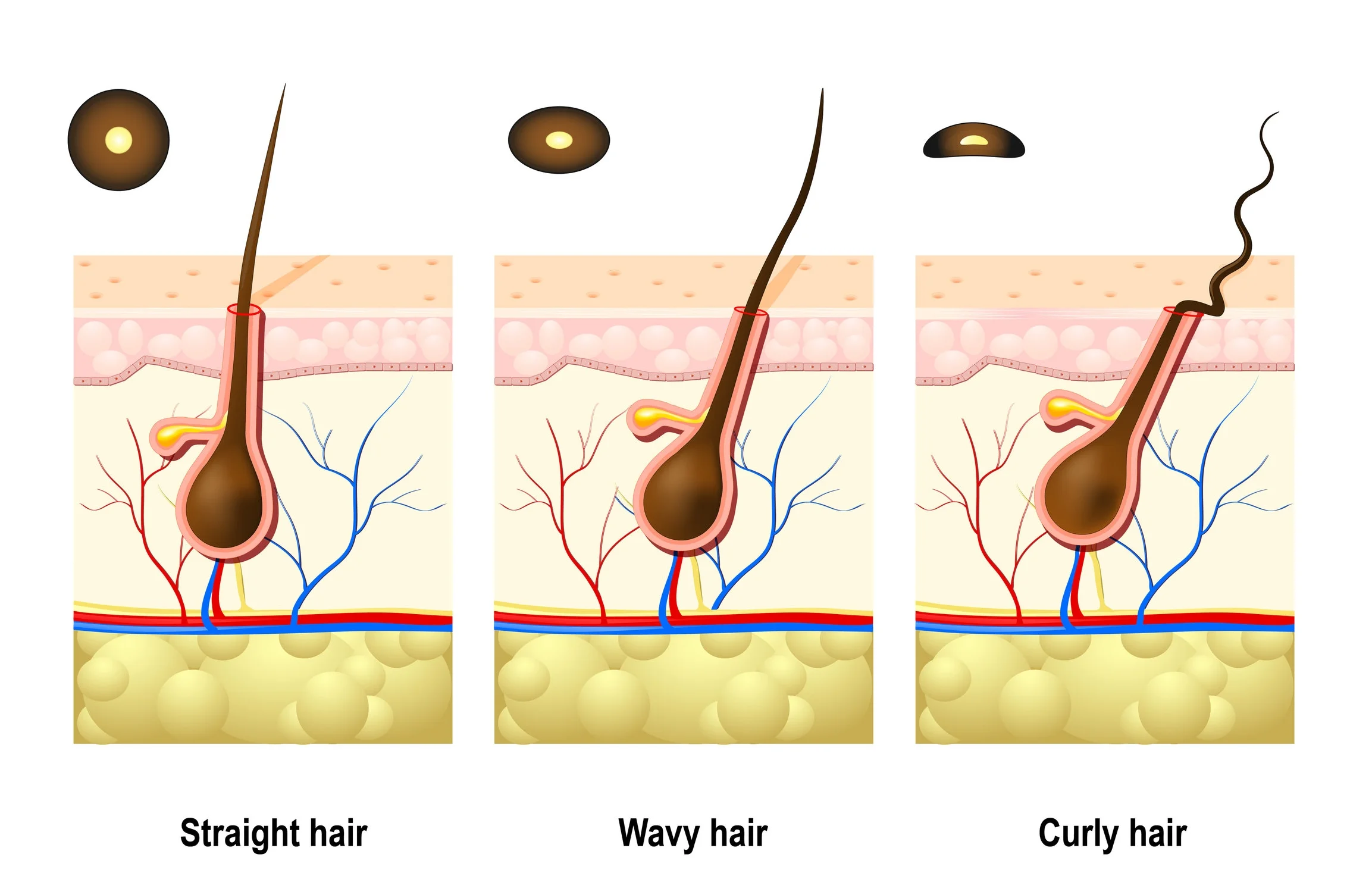 follicle types.jpg