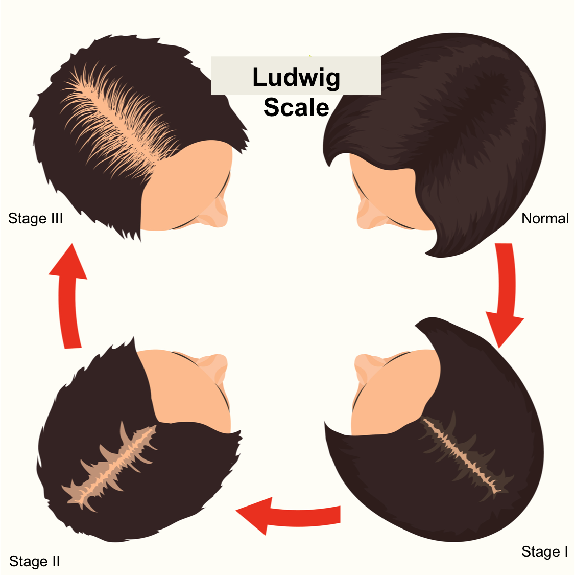 ludwig scale.png