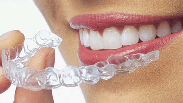 Invisalign for Crowded Teeth: Benefits for Your Smile and Oral Health