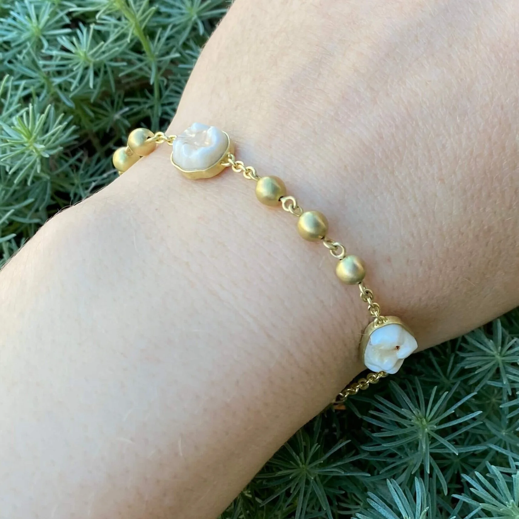 Kate+Eickelberg_Custom+Bracelet+with+Baby+Teeth+in+18k+Yellow+Gold+%28compressed%29.jpg