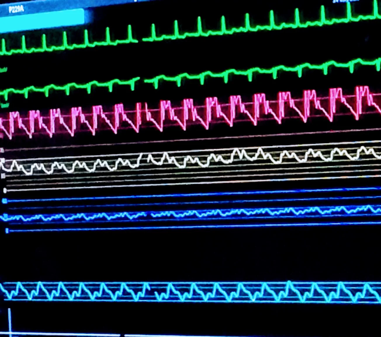 The Sound and the Fury