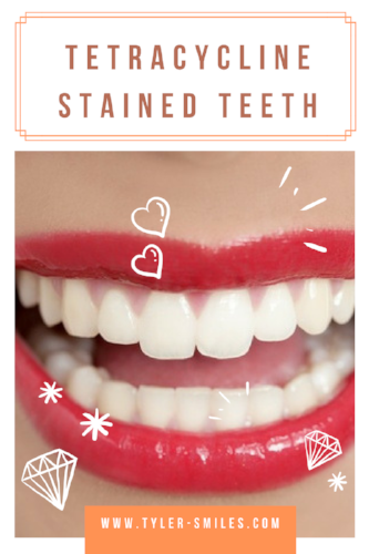 Tetracycline Stained Teeth
