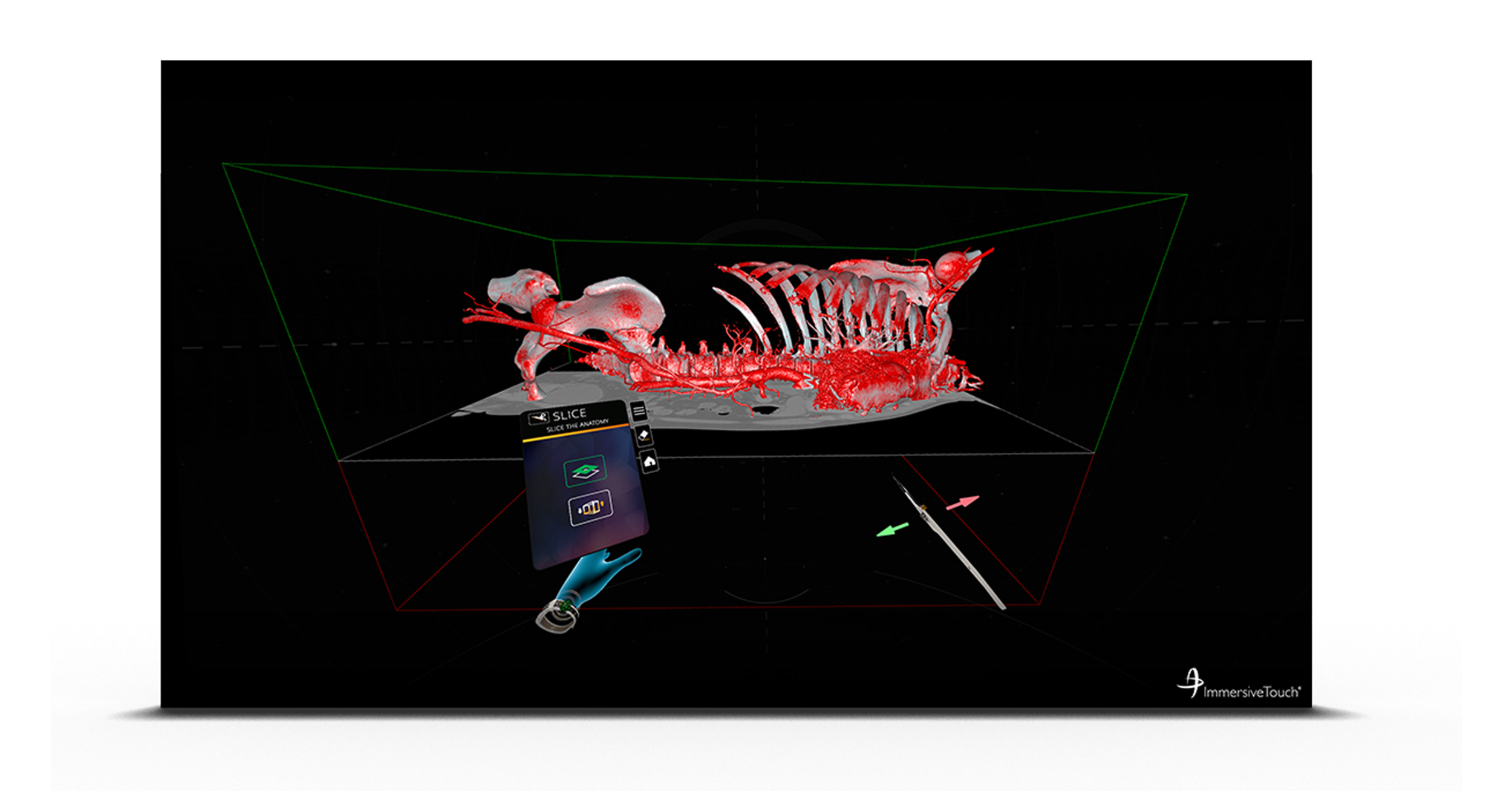 ivsp-image-2.png