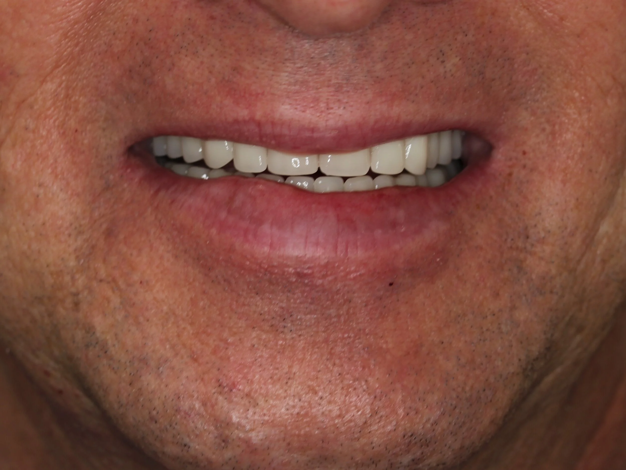 After Smile.JPG