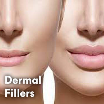 Dermal Fillers