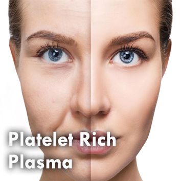 Dermal_Platelet Rich Plasma.jpg