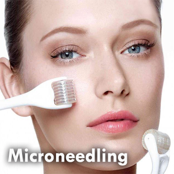 Dermal_Microneedling.jpg